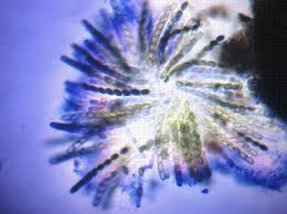 Attēlu rezultāti vaicājumam “Sordaria fimicola”