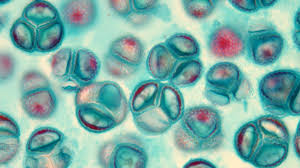 Attēlu rezultāti vaicājumam “Lycogala botrydium spores”