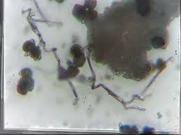 Attēlu rezultāti vaicājumam “Diderma subincarnatum spores”