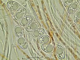 Attēlu rezultāti vaicājumam “Octospora humosa”
