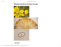 Attēlu rezultāti vaicājumam “Miladina lecithina”