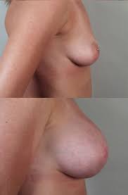 http://t0.gstatic.com/images?q=tbn:ANd9GcTaKb3KZ88ChV5wDXEj5iVG5gft1MGFjOcPprFIDAr8luZZ05FC