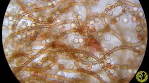 Attēlu rezultāti vaicājumam “Arcyria incarnata”