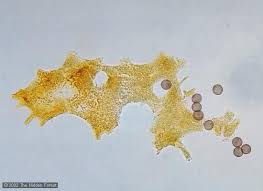 Attēlu rezultāti vaicājumam “Willkommlangea reticulata spores”