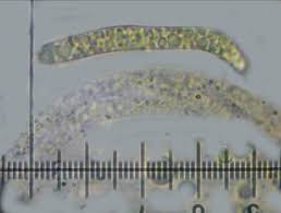 Attēlu rezultāti vaicājumam “Lasiosphaeria ovina spores”