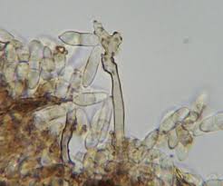 Attēlu rezultāti vaicājumam “Lichenoconium xanthoriae”