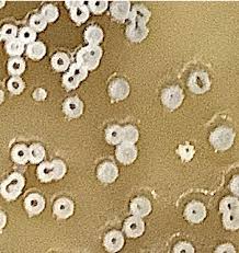 Attēlu rezultāti vaicājumam “Arcyria imperialis stalked”