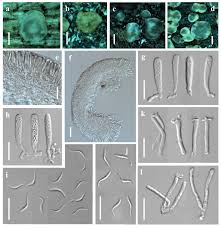 Attēlu rezultāti vaicājumam “Orbilia sp.”