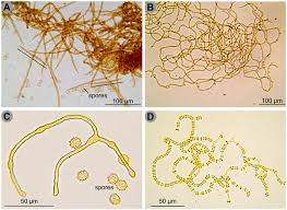 Attēlu rezultāti vaicājumam “Physarum murinum spores”