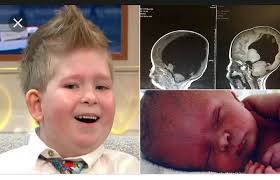 Image result for no brain