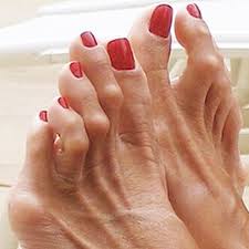 Znalezione obrazy dla zapytania palec