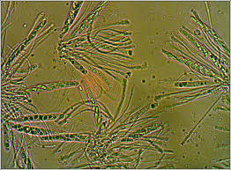 Attēlu rezultāti vaicājumam “Coenogonium pineti”