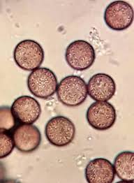 Attēlu rezultāti vaicājumam “Lycogala cf. oleocrystalliferum”