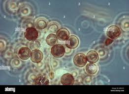 Attēlu rezultāti vaicājumam “Didymium bahiense spores”