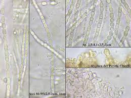 Attēlu rezultāti vaicājumam “Hypocrea pulvinata”