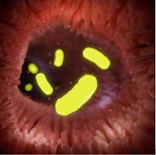 Attēlu rezultāti vaicājumam “Diderma simplex macro”