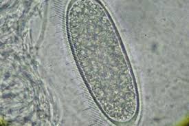 Attēlu rezultāti vaicājumam “Pertusaria leioplaca”