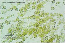 Attēlu rezultāti vaicājumam “Chaenotheca brunneola”