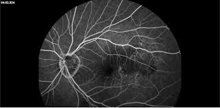 「pvAj[MjA」の画像検索結果