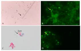 Attēlu rezultāti vaicājumam “Enteridium liceoides spores”