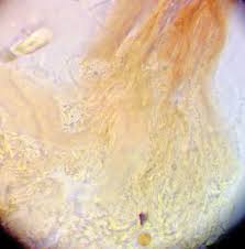 Attēlu rezultāti vaicājumam “Licea pygmaea spores”