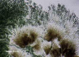 Attēlu rezultāti vaicājumam “Calicium salicinum”