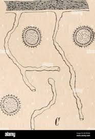 Attēlu rezultāti vaicājumam “Perichaena corticalis spores”