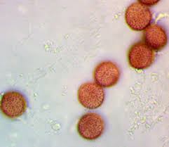 Attēlu rezultāti vaicājumam “Badhamiopsis ainoae spores”