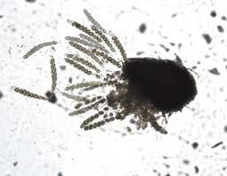 Attēlu rezultāti vaicājumam “Trichia ambigua spores”