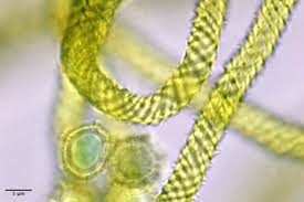 Attēlu rezultāti vaicājumam “Oligonema persimile macro”