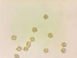 Attēlu rezultāti vaicājumam “Oligonema favogineum”