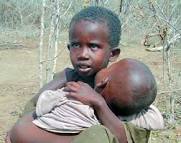صور أطفال الصومال .. وهم يستغيثون Images?q=tbn:ANd9GcTbX7DWumzszwcpeRHAWyf0fvRz9DcP2w-zNtDwshWXb9gqGb1xs2zHdOFT