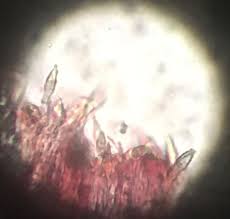 Attēlu rezultāti vaicājumam “Ionomidotis irregularis”