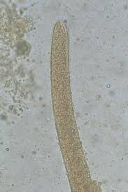 Attēlu rezultāti vaicājumam “Trichia contorta sessile”