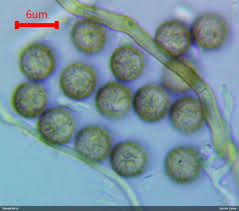 Attēlu rezultāti vaicājumam “Comatricha meandrispora”