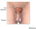 Antidepressants Male Infertility - Health Central