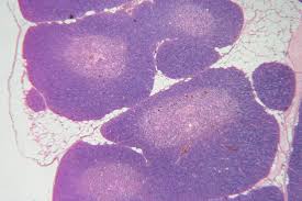 Image result for Thymus