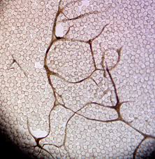 Attēlu rezultāti vaicājumam “Stemonitopsis hyperopta var. landewaldii”