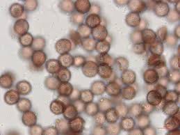 Attēlu rezultāti vaicājumam “Physarum leucophaeum spores”