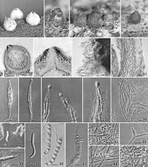 Attēlu rezultāti vaicājumam “Lasiosphaeria ovina spores”
