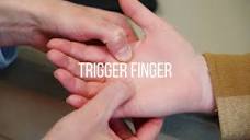 Trigger Finger Symptoms, Causes, and Treatment - YouTube
