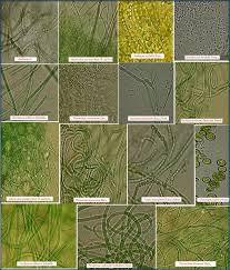 Attēlu rezultāti vaicājumam “Gloeocapsa rupestris”