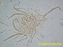 Attēlu rezultāti vaicājumam “Nectria episphaeria”