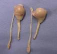 Man Sells Own Testicles on eBay