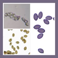 Attēlu rezultāti vaicājumam “Badhamia versicolor spores”