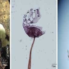 Attēlu rezultāti vaicājumam “Badhamia affinis spores”