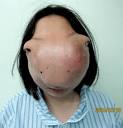 Deformity