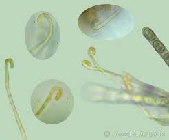 Attēlu rezultāti vaicājumam “Sowerbyella radiculata”