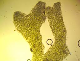 Attēlu rezultāti vaicājumam “Riccardia latifrons”