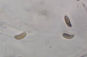 Attēlu rezultāti vaicājumam “Dacrymyces chrysospermus spores”